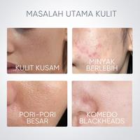 Gambar terlaris SKINTIFIC - Alaska Volcano Pore Clay Stick 40g | Masker Wajah Komedo Skincare BPOM Sleeping Mask Organik Muka Jerawat Bubuk Mugwort Peel Clay Mask Off Pengangkat Komedo Penghilang Jerawat BPOM Acne Mask with Glycolic Acid Probiotic Complex Black dari BUANA JK undefined 3 Tokopedia
