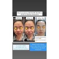 Gambar [Termurah] Trial Masker Bb Glow And Serum Le Acquashine Water Botox At Home Pengencang Wajah Favoured One dari DalamoStore undefined 1 Tokopedia