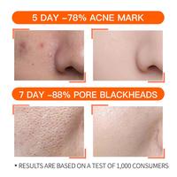 Gambar The Ordinary Salicylic Acid 2% Solution Acne Pimple Remover Serum Blackhead Remover Pore Minimizer dari Тhe Ordinary Stоre undefined 5 Tokopedia