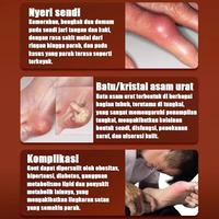 Gambar tr Terapi Kaki Salep Tumit Obat Sakit Tumit Plantar Fasciitis Terapi Pelindung Tumit Kaki Sakit Kemudahan Kaki Kebas Kesemutan Dan Bengkak bk - 1PS dari Cewsinac Official undefined 4 Tokopedia