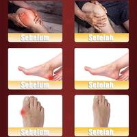 Gambar tr Terapi Kaki Salep Tumit Obat Sakit Tumit Plantar Fasciitis Terapi Pelindung Tumit Kaki Sakit Kemudahan Kaki Kebas Kesemutan Dan Bengkak bk - 1PS dari Cewsinac Official undefined 3 Tokopedia