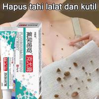 Gambar [ORIGINAL 100%] KRIM FLUOROURACIL KEYOU OINTMENT PENGHILANG KUTIL DAN TAHI LALAT DI WAJAH DAN BADAN PERMANEN TANPA BEKAS dari GUDANG IDM undefined 3 Tokopedia