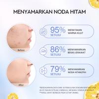 Gambar Glad2Glow Yuja Symwhite 377 Dark Spot Moisturizer Menghilangkan Bekas Jerawat - 1 pcs dari Rich’sStore88 undefined 2 Tokopedia