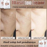 Gambar Lydimoon Masker Wajah Niacinamide/Perbaiki Kulit Kering/Kemerahan/Jerawat/Bintik Hitam/Kerutan/Pelembab Yg Hight Menembus Pencerah & Pelembab/Mengencang Kulit/Masker Wajah Pelembab Aman 0 Aditif Termurah Ready Terbaik - Paket3 dari SATURNDAY- undefined 3 Tokopedia