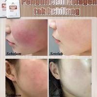 Gambar Lydimoon Masker Wajah Niacinamide/Perbaiki Kulit Kering/Kemerahan/Jerawat/Bintik Hitam/Kerutan/Pelembab Yg Hight Menembus Pencerah & Pelembab/Mengencang Kulit/Masker Wajah Pelembab Aman 0 Aditif Termurah Ready Terbaik - Paket3 dari SATURNDAY- undefined 4 Tokopedia