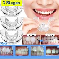 Gambar Ortodontik Transparan Perapih Gigi Invisible Brace Teeth Trainer Allignment Multifungsi 3 Pcs Orthodentic Retainer Behel Kawat Gigi Transparan 3 Step dari anuhrahjaya undefined 4 Tokopedia