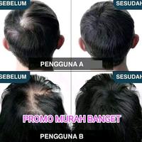 Gambar OBAT PENYUBUR RAMBUT KERANIQ ASLI 100% ORIGINAL HAIR SERUM PENUMBUH RAMBUT BOTAK RONTOK TIPIS PRIA WANITA CEPAT PALING AMPUH ISI 100ML TERMURAH - KERANITY, BELI dari TOKO JAYA LESTARI0 undefined 4 Tokopedia
