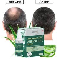 Gambar MINOXIDIL 5% penumbuh rambut & brewok with Aloe Vera for MEN made in USA - RAYGOLD - MINOX MINOKSIDIL anti rontok & kebotakan dari LUMBAR OFICIAL undefined 1 Tokopedia