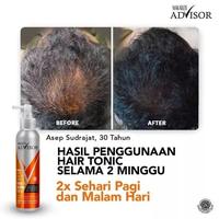 Gambar MAKARIZO Advisor Anti-Hair Loss Hair & Scalp Tonic 65ml 145ml 240ml dari MITRA UTAMA 1_NEW undefined 4 Tokopedia