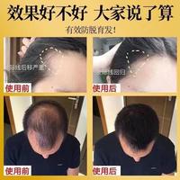 Gambar remimpi shampo anti rontok ampuh menebalkan rambut tipis anti ketombe salsun sampo penumbuh rambut tercepat sampo meluruskan rambut sampo pemanjang rambut cepat sampo penumbuh rambut botak shampo untuk rambut botak shampo remimpi rambut rontok anti botak dari Raisha-Shop001 undefined 2 Tokopedia