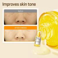 Gambar [BPOM] SOMEBYMI SOME BY MI YUJA NIACIN BLEMISH CARE SERUM YUJA NIACIN ANTI BLEMISH SERUM - 10ml dari Jaya Print Jkt undefined 4 Tokopedia