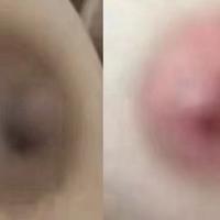 Gambar Kimedi rsc for areola dan private part dari Theluveskin22 undefined 4 Tokopedia