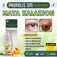 Gambar Propolis SM Bantu Atasi Mata Kalazion Mata Bintitan Di Kelopak Mata Mata Timbilan Benjolan Dekat Mata Bisul Kelopak Mata Nyeri Sakit Mata Bengkak dari Herbaya store undefined 1 Tokopedia