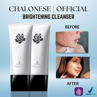 Gambar [CHALONESE] BUY 1 GET 1 BRIGHTENING FACIALWASH 5 Membantu Membersihkan dan Mengurangi Minyak di Kulit Wajah (free mask) dari CHALONESE STORE 1 undefined 3 Tokopedia