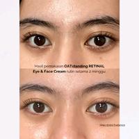 Gambar Finally Found You! FFY OATstanding Retinal 20ml - Krim Mata Penghilang Kerutan Dan Mata Panda Original BPOM dari ChlloeBeauty undefined 2 Tokopedia
