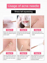 Gambar Blackhead Remover Pimple Comedone Extractor Tool Best Acne Removal Kit Treatment for Blemish Whitehead Popping Zit Removing for dari GROSIRAN TISSU LUSINANN undefined 3 Tokopedia