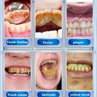 Gambar V34 Colour Corrector Whitening Teeth 30ml Perontok karang gigi paling ampuh Whitening Toothpaste - V34 dari KORMESIC SHOPPING MALL undefined 3 Tokopedia
