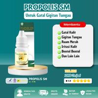 Gambar Propolis Sm Suplemen Kesehatan Untuk Gatal Kulit Akibat Gigitan Tungau Kasur Tumila Ruam Merah Gatal - Propolis Sm dari ObatHerbalTerpercaya undefined 1 Tokopedia