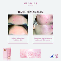 Gambar Glowies Beauty Dreamy Moisturizer 80ml 7% Azeclair Niacinimide Alpha Arbutin 5x Ceramide Pelembab wajah Formulasi Korea membantu Mencerahkan Menghilangkan jerawat PIE PIH Memperbaiki Skin Barrier dan Acne Repair Non Comedogenic Busui Friendly dari Glowies Beauty undefined 3 Tokopedia