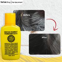 Gambar CAP TIGA JEMPOL Minyak Pembersih Kutu Rambut dan Telurnya AmpuhE - 30 ML TANPA BONUS dari HAVENEST.ID undefined 5 Tokopedia