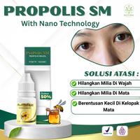 Gambar PROPOLIS SM - Penghilang Milia Di Wajah, Milia Di Mata Atas / Bawah, Bruntusan Kecil Milia Di Kelopak Mata Aman Untuk Anak Dan Dewasan - Herbal dari Naturia Herbal undefined 1 Tokopedia