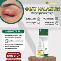 Gambar Mata Bengkak Timbilan Mata Mata Bintitan Mata Kalazion Mata Hordeolum Pengempis Bengkak Di Kelopak Mata sakit Mata Bengkak Propolis SM - ProPolis SM dari Herbalthy Store undefined 1 Tokopedia