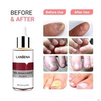 Gambar LANBENA NAIL REPAIR ESSENCE OBAT KUKU ANTI JAMUR PERAWATAN KERUSAKAN PADA KUKU 15ML dari zyvaania.beauty undefined 3 Tokopedia