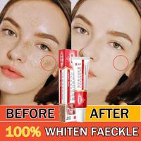 Gambar ranhe - [New] Salep Flek Hitam Melasma Flek Hitam Niacinamide Melasm Cream  Ampuh Whitening Salep Flek Hitam Whitening Salep Flek Hitam Krim Penghilang Flek Menghilangkan Bintik Melasma Untuk Moisturizer Brightening Krim Pencerah Wajah Yang Aman 20g dari ranhe undefined 2 Tokopedia