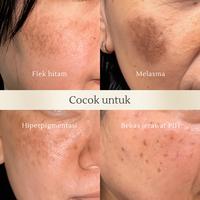Gambar Swissvita Dark Spot Correcting Serum 15gr | Noda gelap | Flek hitam | Bekas Jerawat PIH - 15gr dari Swissvita Indonesia undefined 5 Tokopedia