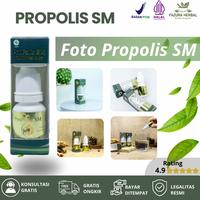 Gambar Propolis SM - Kulit Bersisik Kulit Kasar Kulit Sering Mengelupas Kulit Kepala Berkerak Psoriasis Kulit Ichthyosis Vulgaris Gatal Bersisik,  Kulit Pecah Pecah, Kulit Bruntusan Hitam dari Fazura Herbal undefined 4 Tokopedia