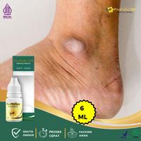 Gambar Mata Kaki Hitam, Penghilang Hitam Di Mata Kaki, Kapalan Kaki Tebal, Kaki Pecah Pecah Dan Kering, Mata Kaki Bengkak Kering Hitam - propolis SM dari Dina Herbal undefined 1 Tokopedia