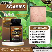 Gambar Atasi Gatal Scabies, Ruam Merah Gatal Panas Dan Perih, Bintik Merah Di Kulit, Kulit Panuan Dengan Herbal Proskin Ekstrak Daun Binahong Isi 60 Kapsul dari Alami Herbal Store undefined 1 Tokopedia