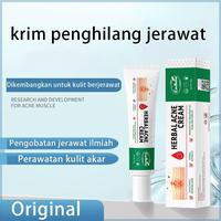 Gambar CINSULIN Salep penghilang jerawat untuk mengatasi jerawat dan bekas jerawat, menghilangkan bekas jerawat pada remaja, memudarkan komedo dan memperbaiki bekas jerawat.jerawat remaja, pelajar Wajah Berjerawat Gatal Bopeng Bekasnya - Default dari Shiyuan Technology undefined 3 Tokopedia