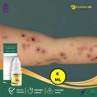 Gambar ProPolis SM Darah Manis/Prurigo, Penghilang Gatal Kulit, Penyakit Darah Manis, Korengan Kaki Dan Tangan, Peradangan Kulit, Kulit Korengan - Propolis SM dari Dina Herbal undefined 1 Tokopedia