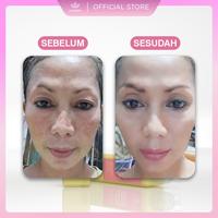 Gambar HIQWEEN ESSENCE TONER RETINOL 16X HYALURONIC ACID menghidrasi kulit lebih dalam mencerahkan kulit, gentle untuk kulit Kering Kusam Sensitif dari Hiqween_NEW undefined 2 Tokopedia