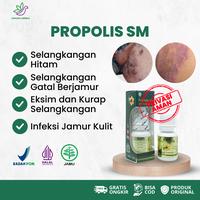 Gambar Obat   Selangkangan Hitam dan Gatal, Selangkangan Berjamur,   Psoriasis,   Pemutih Selangkangan Hitam, Gatal Ruam Jamur Eksim Kurap di Selangkangan, Perawatan Tubuh Selangkangan Lecet Kering dan Menghitam Untuk Pria dan Wanita Propolis SM dari Asmara Herbal undefined 1 Tokopedia