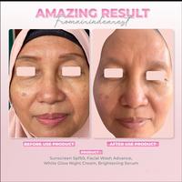 Gambar Airnderm Aesthetic Brightening Serum (Vitamin C 15%) (by AIRIN BEAUTY) dari Airnderm by Airin Beauty undefined 5 Tokopedia