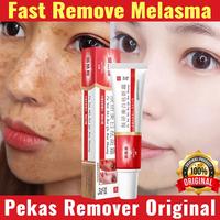 Gambar ranhe - [New] Salep Flek Hitam Melasma Flek Hitam Niacinamide Melasm Cream  Ampuh Whitening Salep Flek Hitam Whitening Salep Flek Hitam Krim Penghilang Flek Menghilangkan Bintik Melasma Untuk Moisturizer Brightening Krim Pencerah Wajah Yang Aman 20g dari ranhe undefined 1 Tokopedia