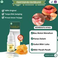 Gambar Propolis SM Obat Tetes Kumur Untuk Sariawan Di Mulut Bau Mulut Menahun Panas Dalam dari DanielHerbalShop undefined 1 Tokopedia