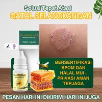 Gambar Perawatan Herbal Selangkangan Hitam Dan Gatal, Jamur Selangkangan, Gatal Selangkangan, Selangkangan Lecet, Infeksi Gatal Pada Kemaluan Pria Dan Wanita, Penghilang Kutu Kemaluan, Gatal Di Bulu Kemaluan, Jamur Kelamin dari Dina Herbal undefined 1 Tokopedia