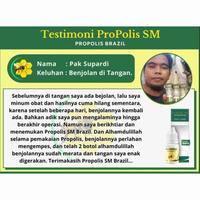Gambar Propolis SM Obat Herbal untuk Menghilangkan Benjolan di Tangan dan Pergelangan Tangan dari Khal Herbal undefined 2 Tokopedia