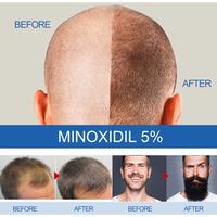 Gambar MINOXIDIL KIRKLAND 5% ORIGINAL - PENUMBUH RAMBUT DAN BREWOK Serum Penumbuh Rambut Botak Minoxidil Oil Rambut Obat Penumbuh Rambut Hair Growth Serum Minyak Penumbuh Rambut Botak - MNDRPZ-60ML dari Kirkland-A-indonesia undefined 4 Tokopedia