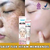 Gambar Krim penghilang flek hitam cream flek hitam membandel salep flek hitam membandel 20g menghilangkan flek hitam di wajah serum flek hitam Perawatan wajah Krim bintik Perbaikan bekas luka dan bintik bintik secara permanen dan efektif dari NIRMALAOFFICIALSTORE undefined 1 Tokopedia