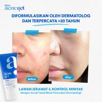 Gambar ERHA Acneact ACSBP (Acne Cleanser Scrub Beta Plus) 60g - Sabun Wajah dengan Scrub Lembut untuk Kulit Jerawat | BHA & Sulfur - 60g dari ERHASTORE OFFICIAL undefined 4 Tokopedia