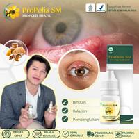 Gambar Propolis SM Herbal Kalazion Bintitan Perawatan Mata Bintintan isi 6ml dari Ghifary Herbal undefined 1 Tokopedia