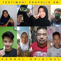 Gambar Herbal Penghilang Benjolan Di Daun Telinga, Benjolan Di Belakang Telinga, Keloid Bekas Luka Tindik - Propolis SM Ear Kotoran Gatal Kuping dari Elvin Herbal_NEW undefined 5 Tokopedia