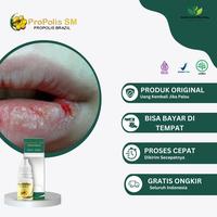 Gambar Propolis SM Obat Tetes  Cairan Sariawan Bibir  Kering  Merah , Sariawan Radang Berdarah, Bibir Pecah Pecah, Panas Dalam, Sariawan Mulut Susah Sembuh dari Sheilda herbal Shop undefined 1 Tokopedia
