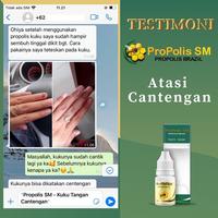 Gambar Propolis SM Untuk Cantengan Jempol Kaki Kuku Rusak Bengkak Bernanah Berdarah Kuku Jamuran dari Safari Healthy undefined 3 Tokopedia