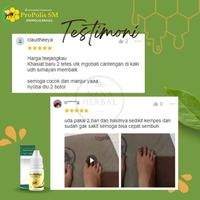 Gambar Herbal Tetes Oles Cantengan Kuku Jempol Kaki Akibat Jamur, Paronikia, Kuku Bengkak, Kuku Rusak, Ny3ri Kuku - Propolis SM isi 6 ml dari Arsyherbalstore_NEW undefined 4 Tokopedia