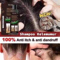 Gambar Shampo Kutu Rambut Anak dan Dewasa shampoo kutu rambut shampoo anti ketombe obat kutu rambut [halal] menghilangkan kutu&telurnya / menghilangkan ketombe&gatal/Memperbaiki Kulit Kepala/Kontrol Minyak Rambut Lebih Halus dari BeliCepat ID undefined 1 Tokopedia